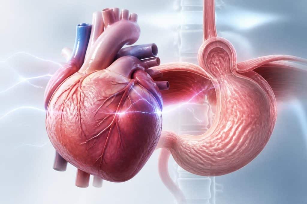 découvrez comment l'hernie hiatale peut influencer les extrasystoles et comprendre le lien crucial entre les troubles de l'estomac et la santé cardiaque.